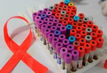 El retraso del diagnóstico del VIH en embarazadas empeora enfermedad en hijos