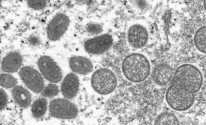 Aumenta capacidad de pruebas de viruela símica en Estados Unidos